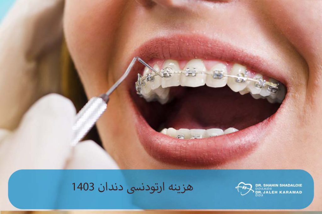 هزینه ارتودنسی دندان 1403